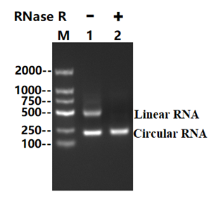 核糖核酸酶 R,RNase R
