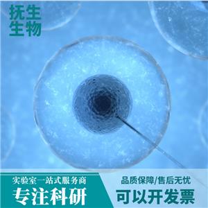 人神经胶质细胞瘤细胞带绿色荧光 ;U251/GFP