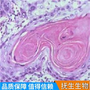 人肺癌细胞；A549/OVA