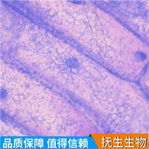 人舌鳞癌细胞；UPCI:SCC154