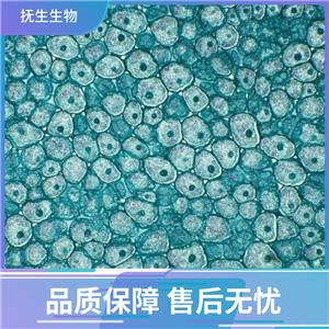 LS180人结肠癌细胞,LS180:LS180