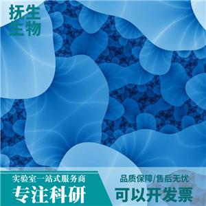 HuTu 80人十二指肠腺癌细胞,HuTu80:HuTu 80