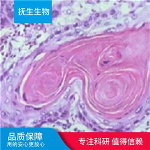 Caov-3人卵巢癌细胞