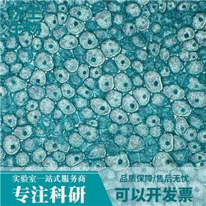 MV-4-11人白血病细胞,MV411:MV-4-11