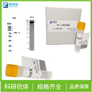 IRE1蛋白抗体,IRE1 Rabbit pAb