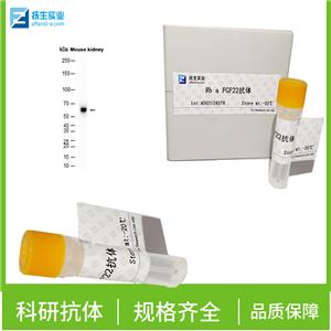 GATA结合蛋白6抗体