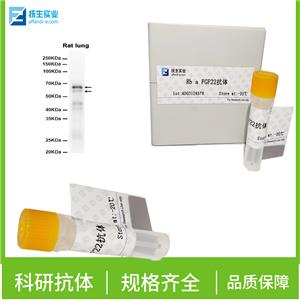 磷酸化蛋白激酶B抗体