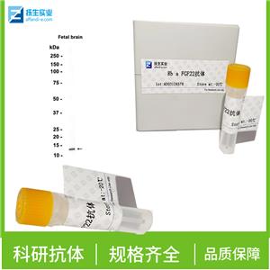 磷酸化蛋白激酶MST抗体,Phospho-Mst1(Thr183) + Mst2(Thr180) Rabbit pAb