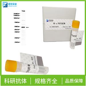 磷酸化蛋白酪氨酸激酶JAK-2抗体