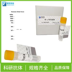 磷酸化非受体型酪氨酸蛋白激酶抗体