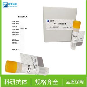 粒细胞-巨噬细胞克隆刺激因子抗体