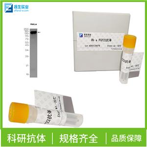 淋巴细胞抗原6重复位点蛋白G6F抗体