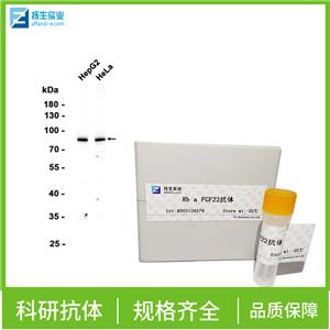 基质金属蛋白酶13抗体