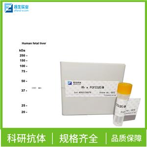 过氧化酶活化增生受体γ抗体