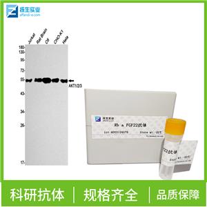 环氧合酶2/前列腺素内过氧化物合成酶2抗体,Cyclooxygenase 2 Rabbit pAb