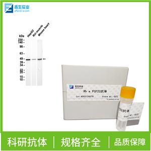 促卵泡刺激素受体抗体