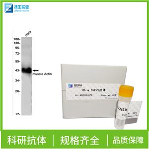 雌激素受体β 抗体