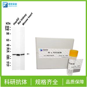 Wnt蛋白家族7B抗体,WNT7B Rabbit pAb