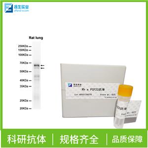 β-连环蛋白/β-连环素/β链接素单克隆抗体,Beta catenin Mouse mAb