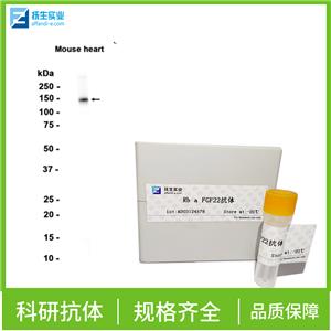 α-(1,3)-岩藻糖基转移酶 4抗体,FUT4 Rabbit pAb