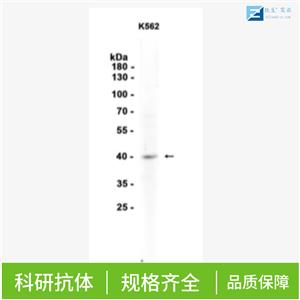 磷酸化RhoA蛋白抗体,Phospho-RhoA (Ser188) Rabbit pAb