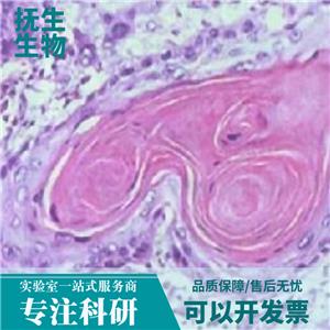 人单核白血病细胞带绿色荧光；THP-1/GFP,THP-1/GFP