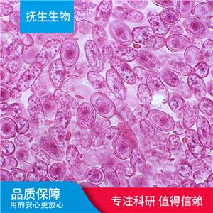 人肾透明细胞癌细胞带绿色荧光；Caki-2/GFP