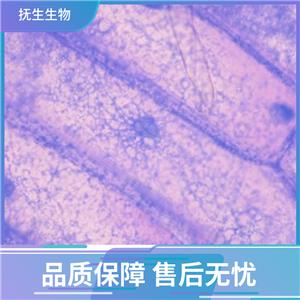 人胃肠道间质瘤细胞；GIST-T1,GIST-T1