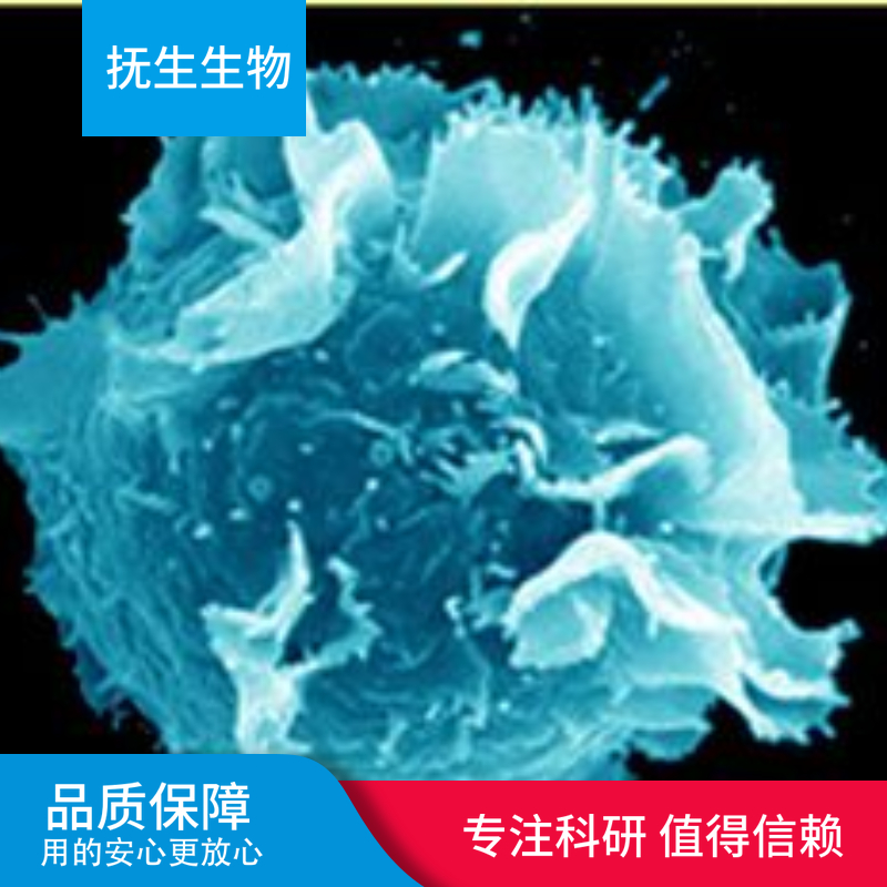 人胆囊癌细胞系；ZJU-0430GBC-SD,ZJU-0430GBC-SD