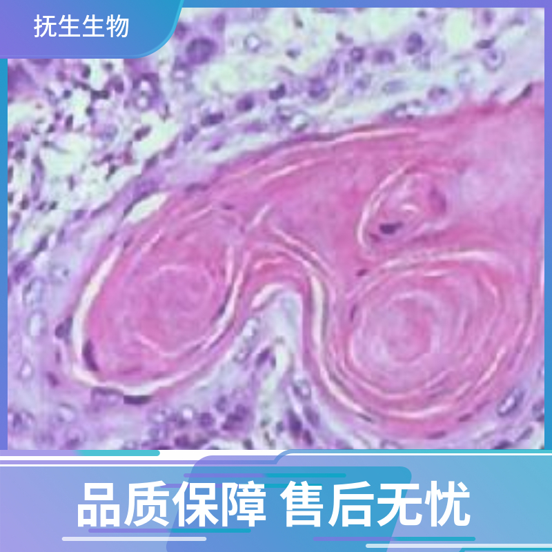 人膀胱癌细胞带荧光素酶；5637/LUC (STR),HCT-116/GFP