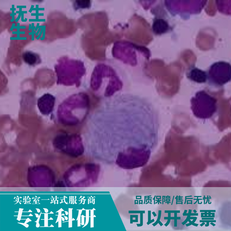 人非小细胞肺癌细胞带荧光素酶；NCI-H1299/LUC (STR),CCC-HPE-2