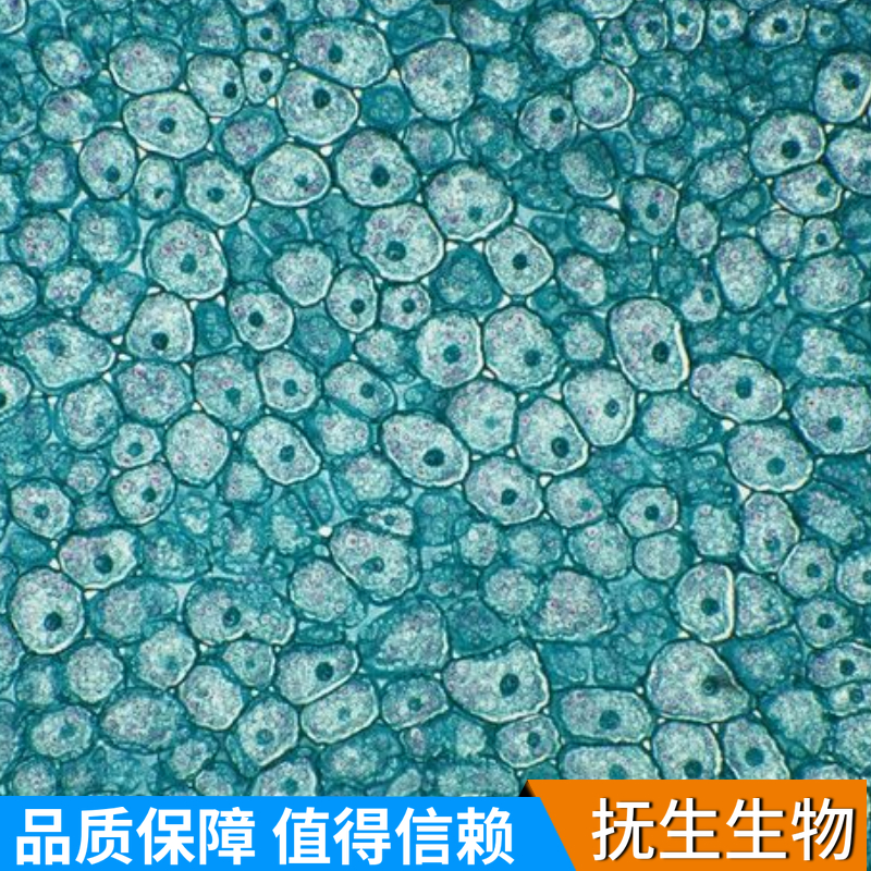 人骨髓增生异常综合征细胞株；MUTZ-1 (STR),MUTZ-1