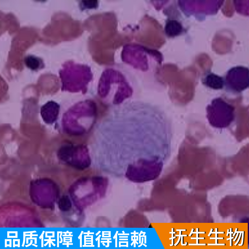 人膀胱移行细胞癌细胞带荧光素酶；T24/LUC (STR),T24/LUC