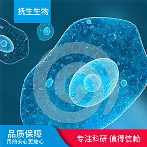 人肝星形细胞+GFP；LX-2+GFP,LX-2+GFP