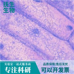 人Burkkit淋巴瘤细胞带荧光素酶；Daudi/LUC (STR)