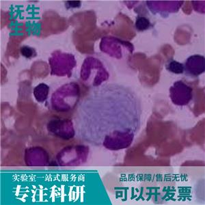 人非小细胞肺癌细胞带荧光素酶；NCI-H1299/LUC (STR)