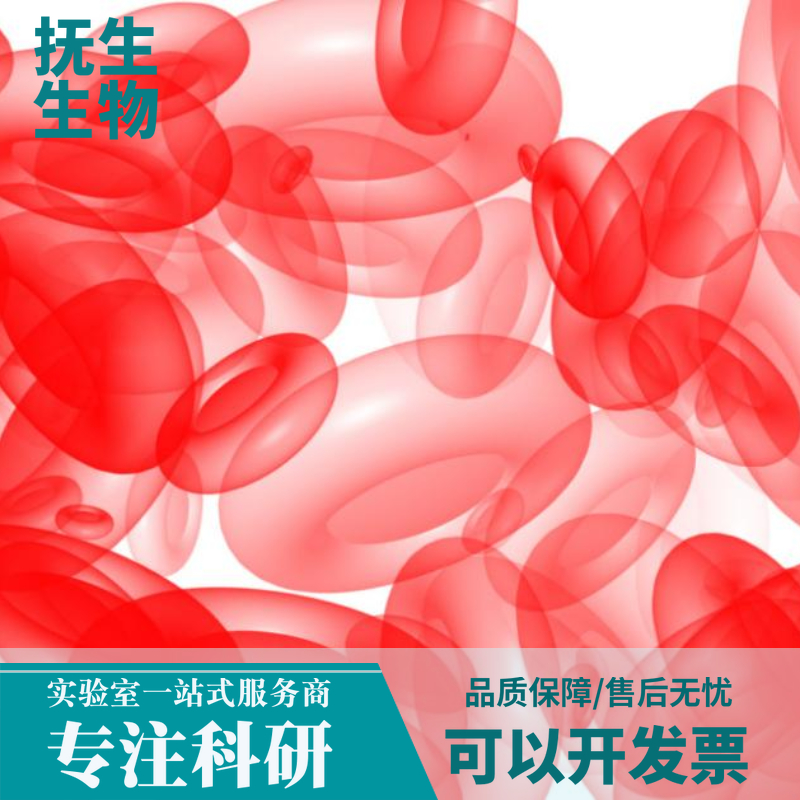 人弥漫大B淋巴瘤细胞；OCI-Ly7,OCI-Ly7