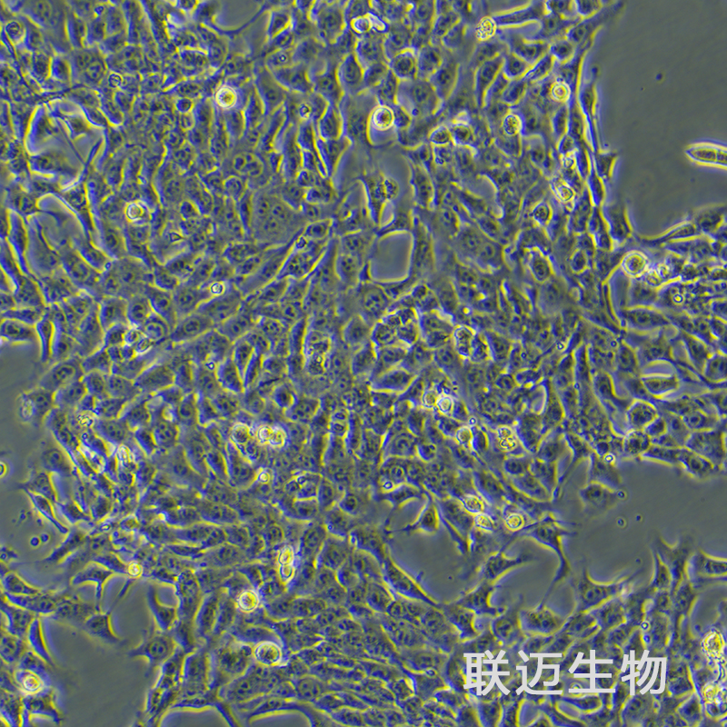 4T1细胞（小鼠乳腺癌细胞）LM8C0007,4T1