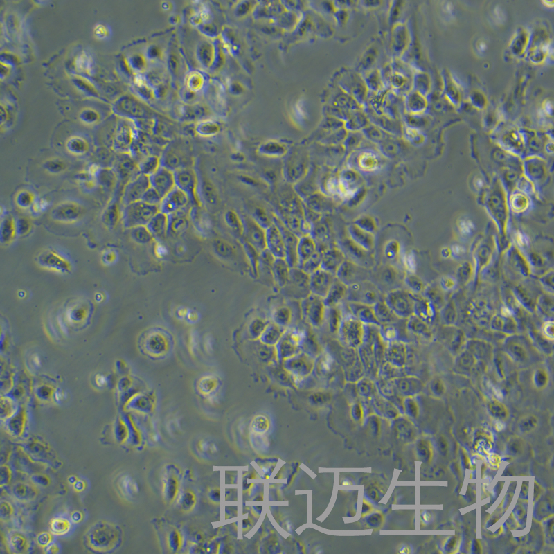 NCI-H292细胞（肺癌细胞淋巴结转移STR鉴定正确）LM8C0167,NCI-H292