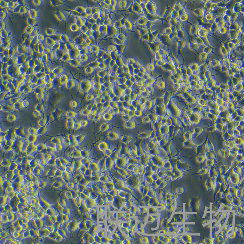 NG108-15[108CC15]细胞（小鼠神经细胞瘤与大鼠神经胶质瘤之融合细胞）LM8C0170,NG108-15[108CC15]