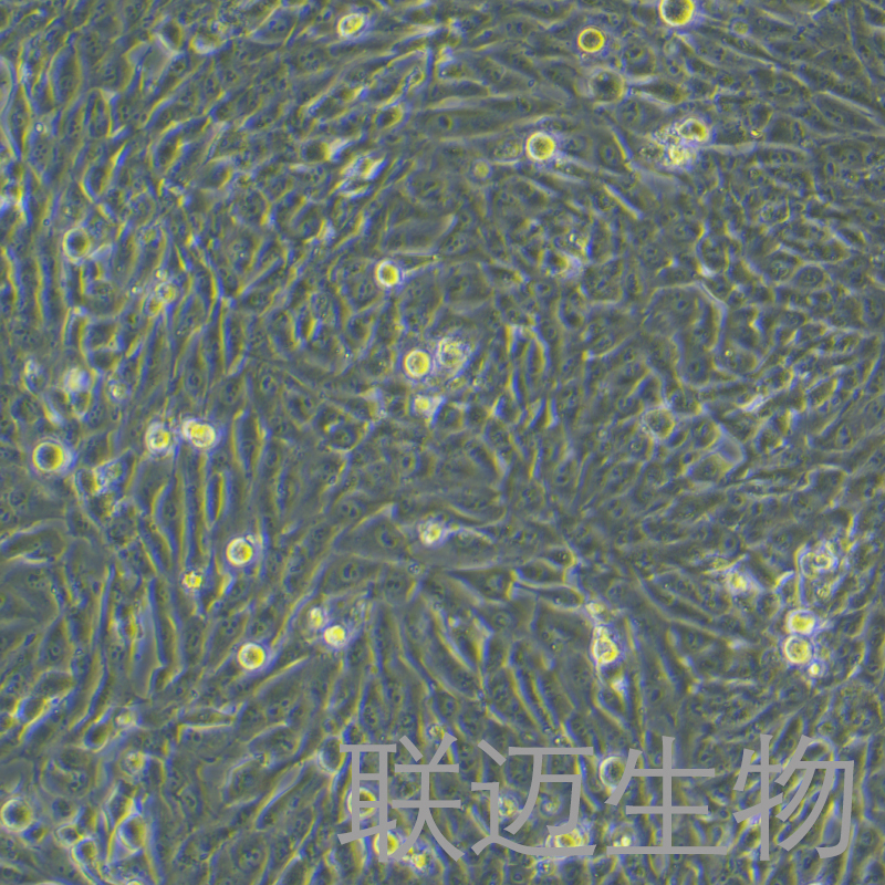 MG-63细胞（骨肉瘤细胞STR鉴定正确）LM8C0157,MG-63