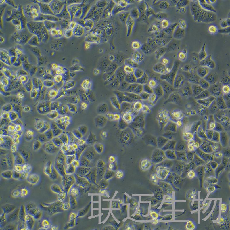 HEC-1-A细胞（子宫内膜腺癌细胞STR鉴定正确）LM8C0099,HEC-1-A