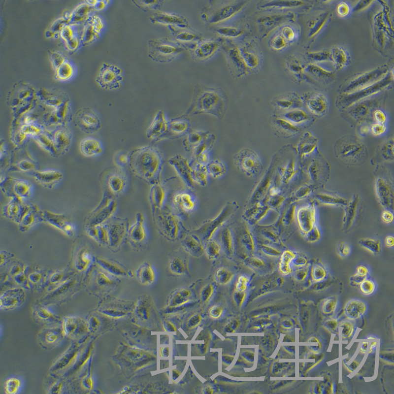 OS-RC-2细胞（肾癌细胞STR鉴定正确）LM8C0188,OS-RC-2