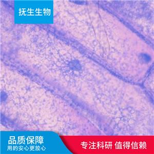 EBV-转化人淋巴细胞；EBV-Human,EBV-Human