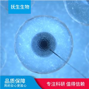 EBV-转化人淋巴细胞；KM9304,KM9304