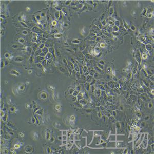 NCI-H292细胞（肺癌细胞淋巴结转移STR鉴定正确）LM8C0167