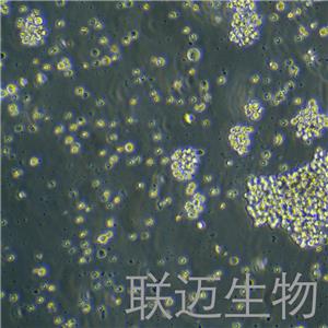 HuT102细胞（T淋巴瘤细胞）LM8C0121
