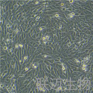 MG-63细胞（骨肉瘤细胞STR鉴定正确）LM8C0157,MG-63