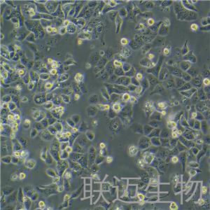 HEC-1-A细胞（子宫内膜腺癌细胞STR鉴定正确）LM8C0099