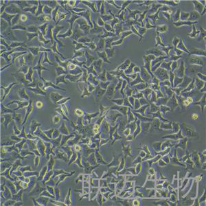 HEp-2细胞（喉表皮样癌细胞）LM8C0104,HEp-2